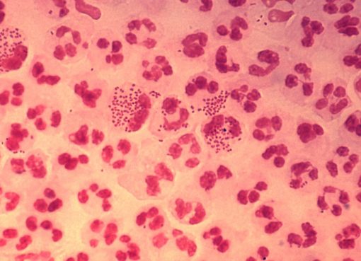 Gonokokken Neisseria gonorrhoeae